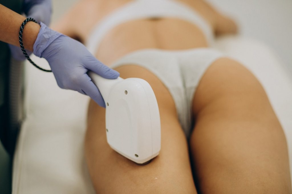 Cand poți apela la epilare cu laser